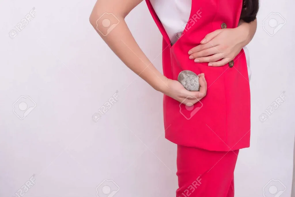 Kidney Stones 2
