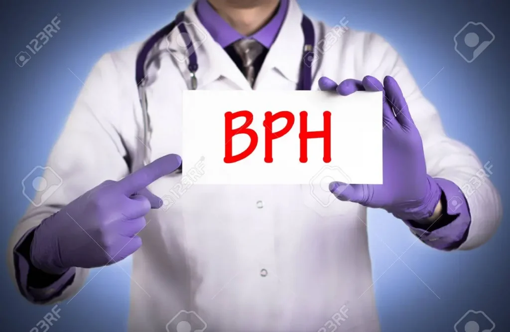 benign prostatic hyperplasia 2