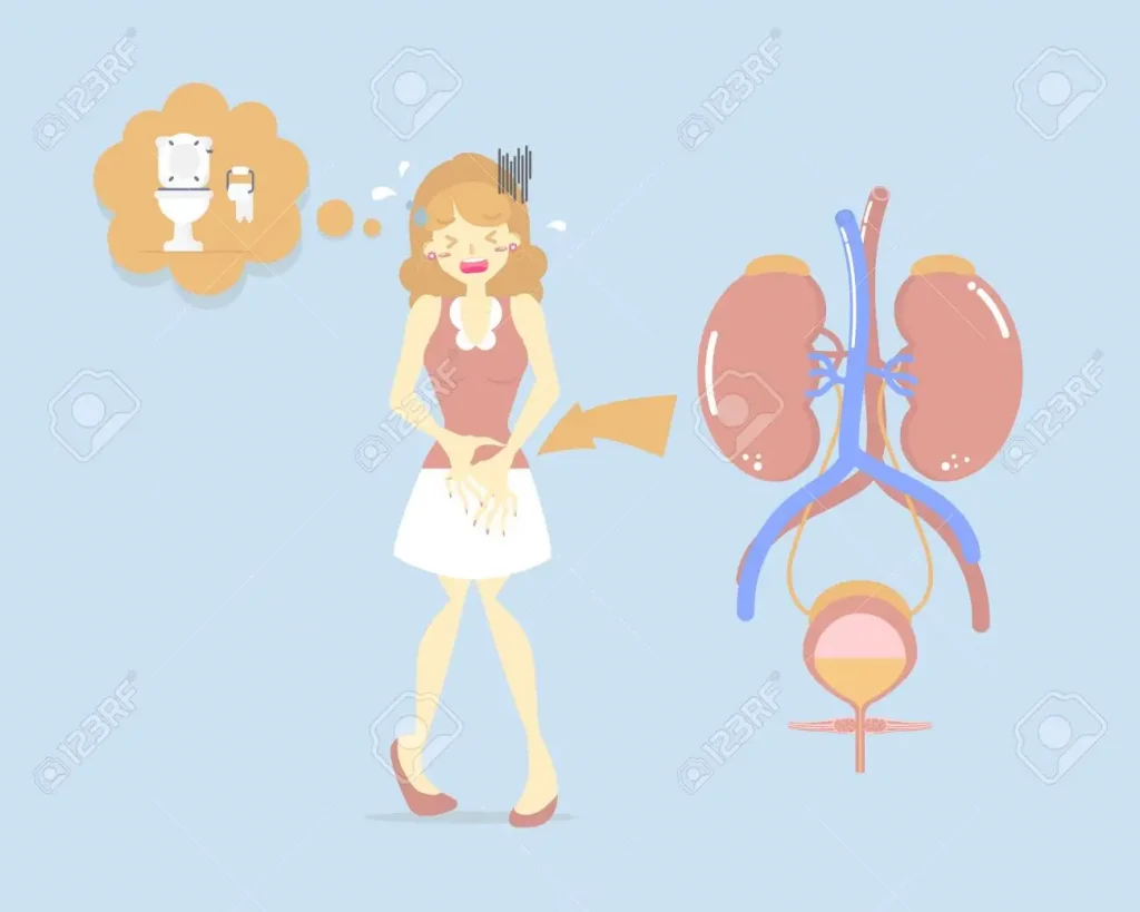 interstitial cystitis 3